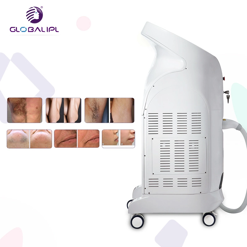 OEM New Product Permanent Laser Epilator Hair Removal Machine