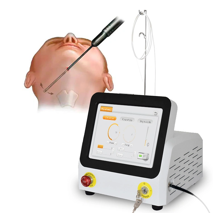 Tratamiento de cirugía mini-invasiva con láser para levantar y reafirmar el rostro. Equipo médico de lifting facial Endolift de 1470 nm.