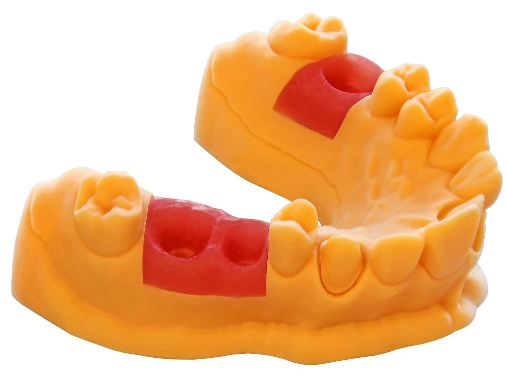 Prismlab 405nm Dental Photopolymer Resin UV SLA 3D Printer for Dental Model