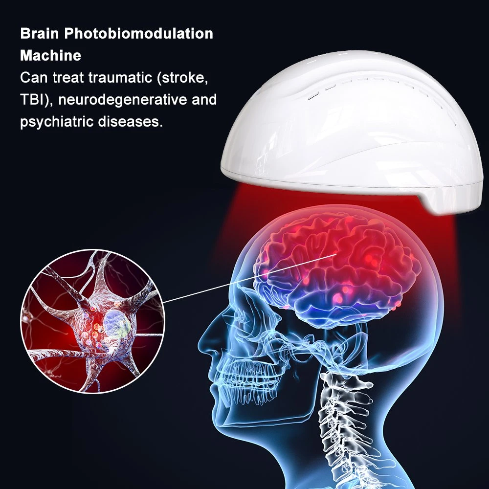 Suyzeko 810nm 256PCS Regulador biológico del cerebro mejora la capacidad cognitiva Infrarrojo Casco de terapia de luz