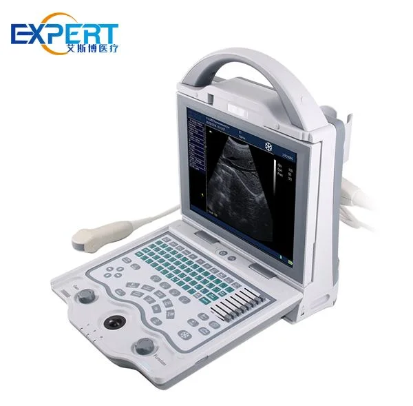 Em-G12 Medical 4D Digital Ultrasound Scanner Portable Medical Ultrasound Machine