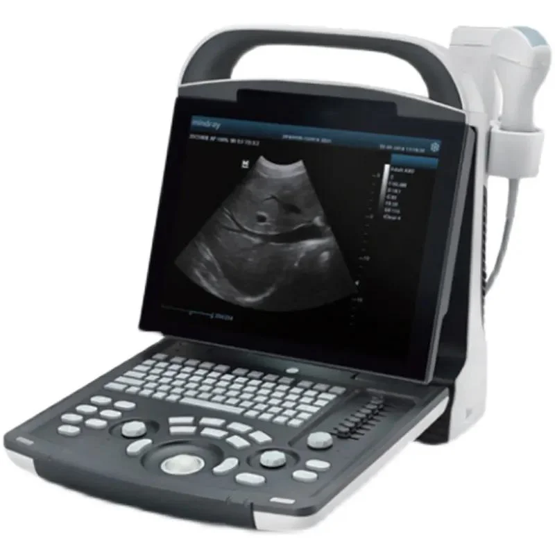 Ultrasound Dp10 USG Mindray Dp-10 Echographie Machine Fabrication Gel Echographie