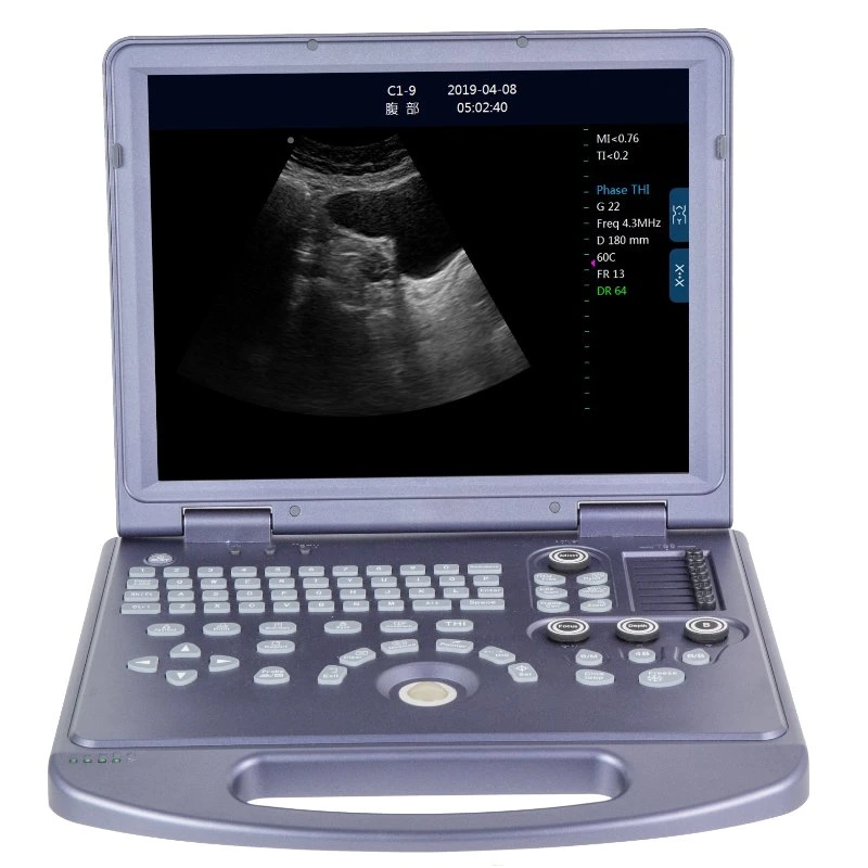 Dw-360 2D Pw Portable B&W Ultrasound Machine From Quality Factory