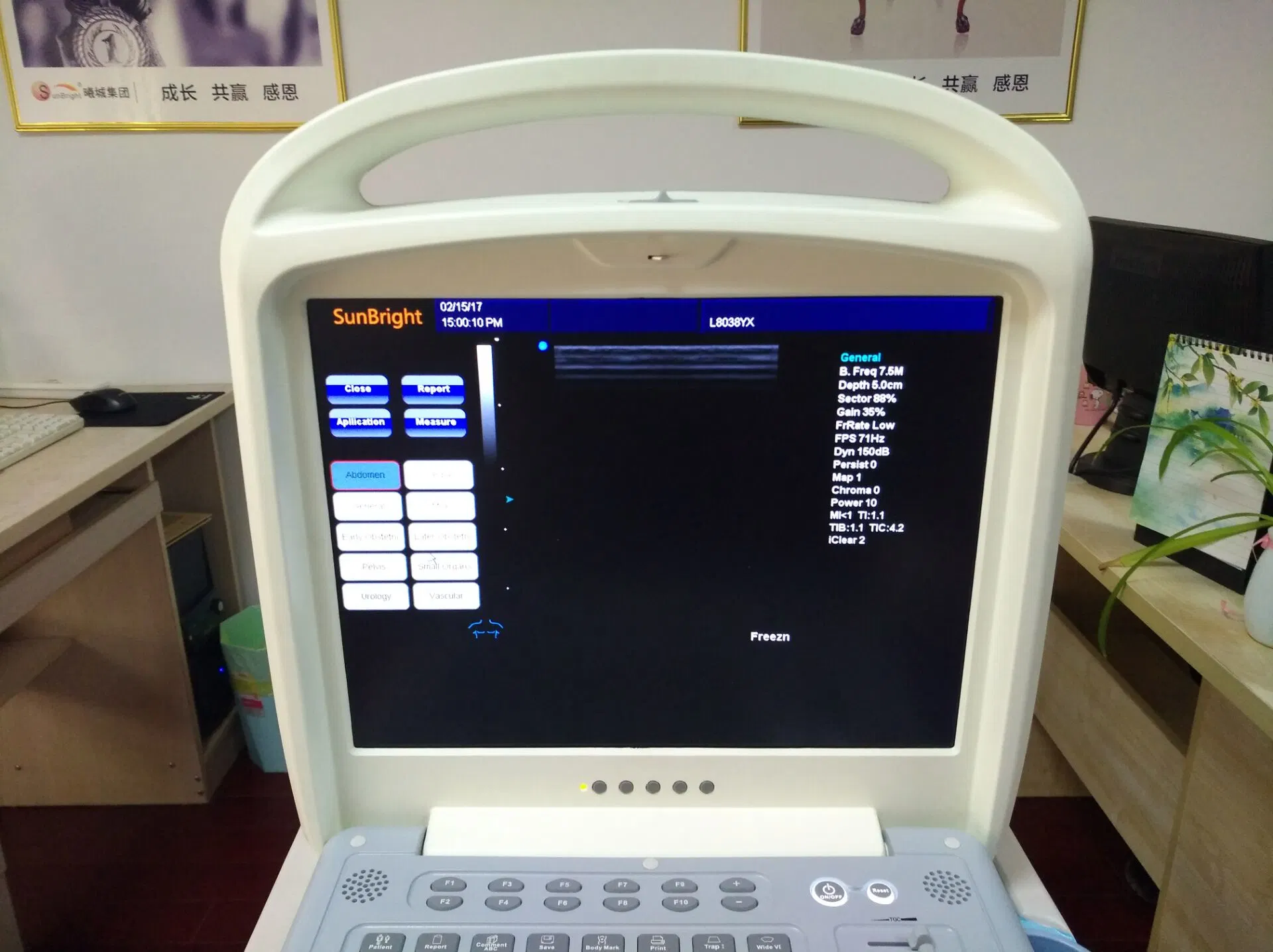 Sun-906W Doppler Ultrasound Equipment Type Portable Color Doppler System