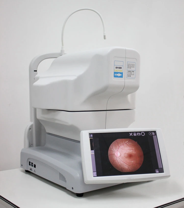 My-V036b Auto Detected The Eye Position Fundus Camera Digital Fundus Photography Retina Camera Price for Ophthalmology