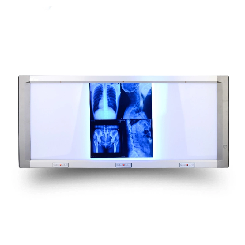 Super Thin Portable Double Panel X Ray LED Medical Film Viewer