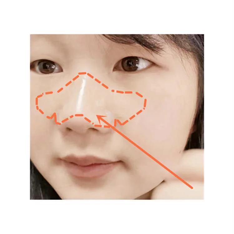 W-Shape Nose Sticker Hydrocolloid Anti-Acne Blackhead Horny Artificial Skin Manufacturer