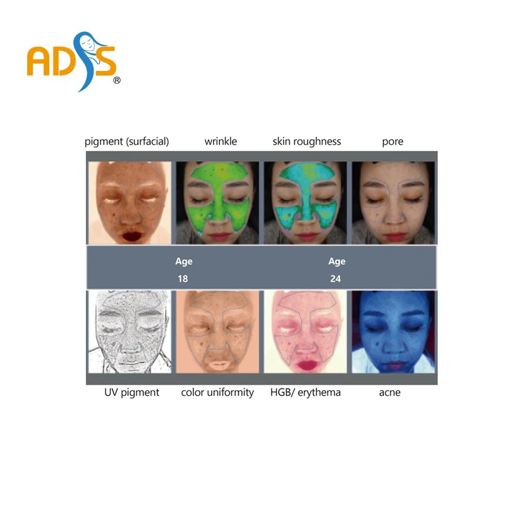 Facial Imaging Analysis Skincare System Medical Grade 3D Skin Analyzer