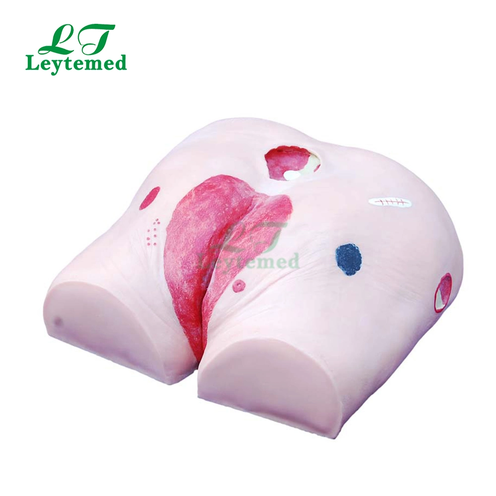 Ltm438 PVC Decubitus Ulcer Care Model for Medical Teaching