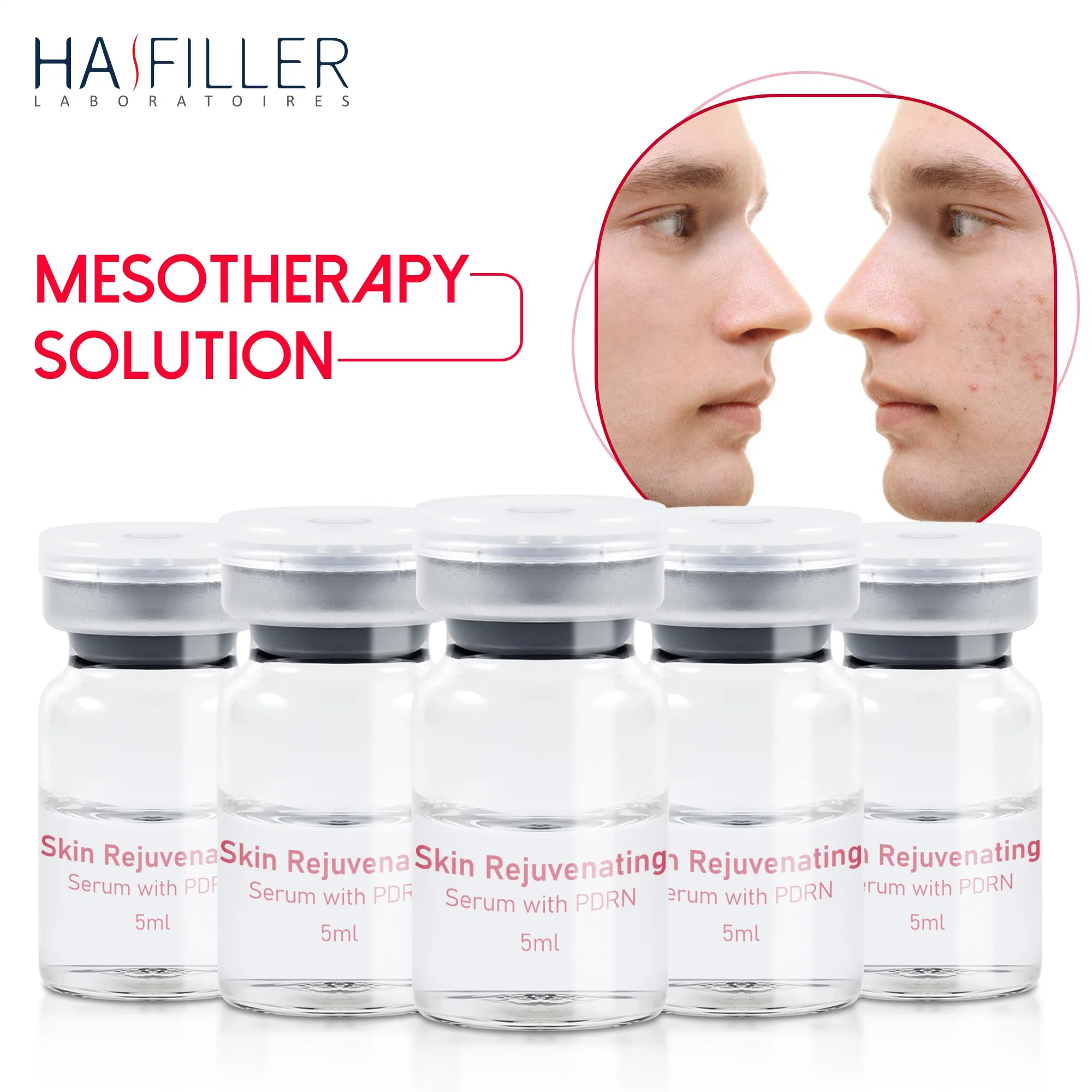 Hot Selling Anti Wrinkle Skin Rejuvenation Serum Pdrn Hyaluronic Acid Injection Mesotherapy