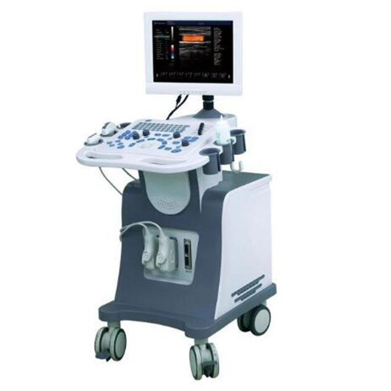 Color Doppler Ultrasound Scanner 3D