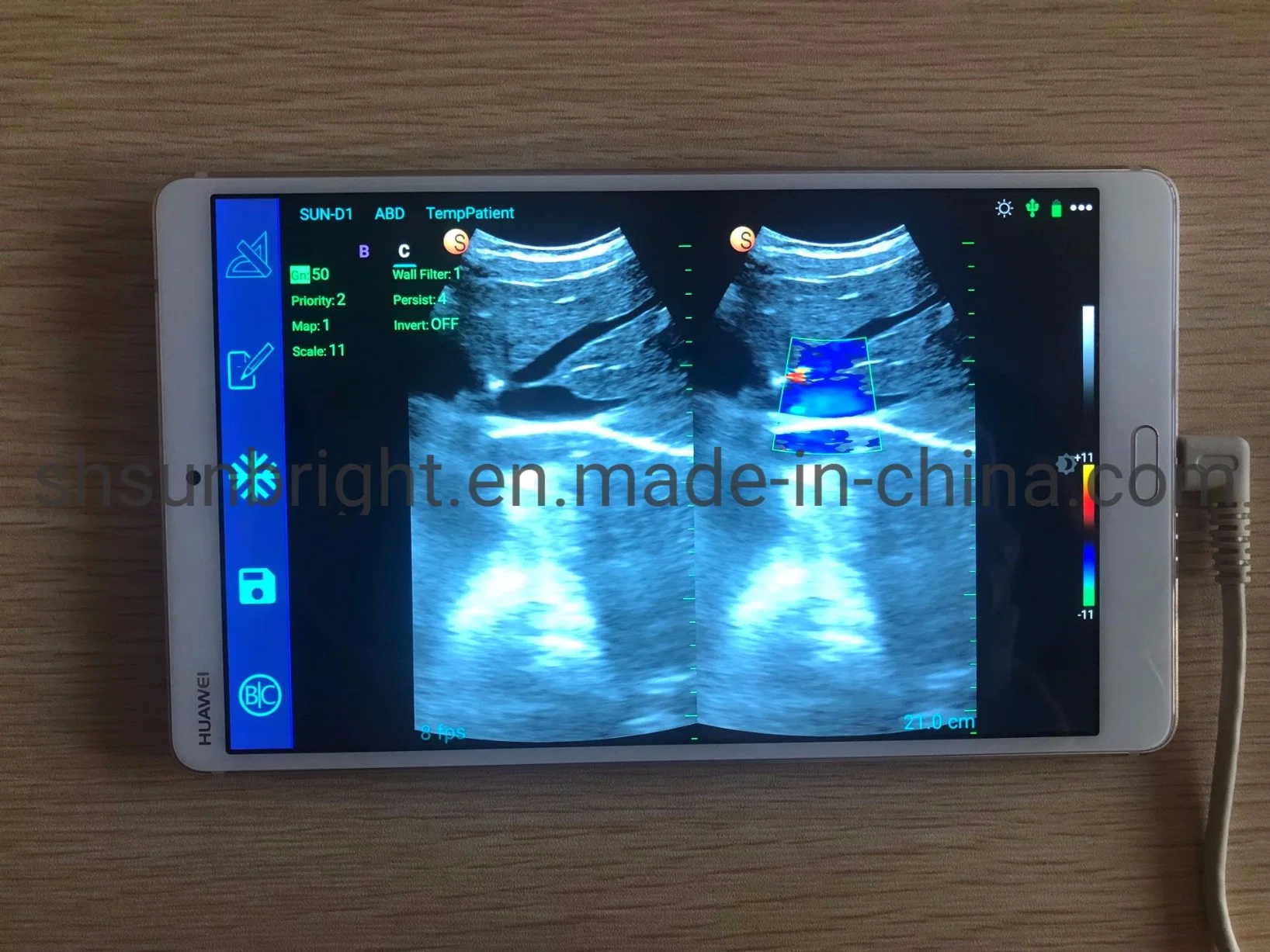 Color Doppler Ultrasound Waterproof Ultrasound Convex Sensor with Best Price