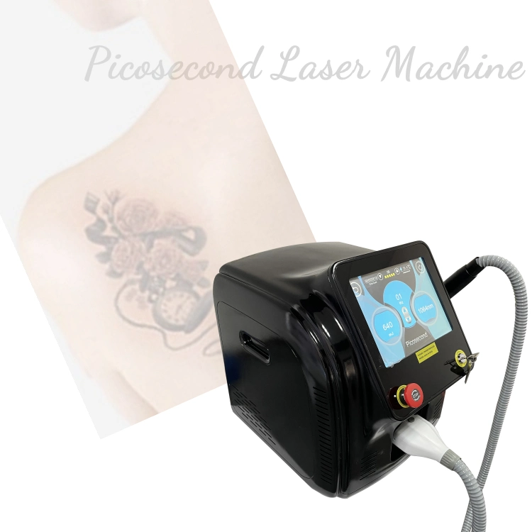 755nm Laser Freckles/Lentigines Removal Pigmentation Laser Rejuvenation Treatment for Asian Skin Age Spots 1064nm 532nm Laser Tattoo Removal Picosecond Laser