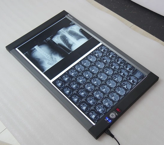 LED X Ray Viewer, Negatoscope, Medical Film Viewer Double Screen Zg-2c