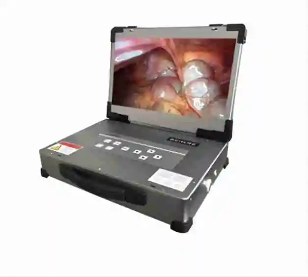 Medical Integrated Endoscopy with Full HD Endoscopic Camera System