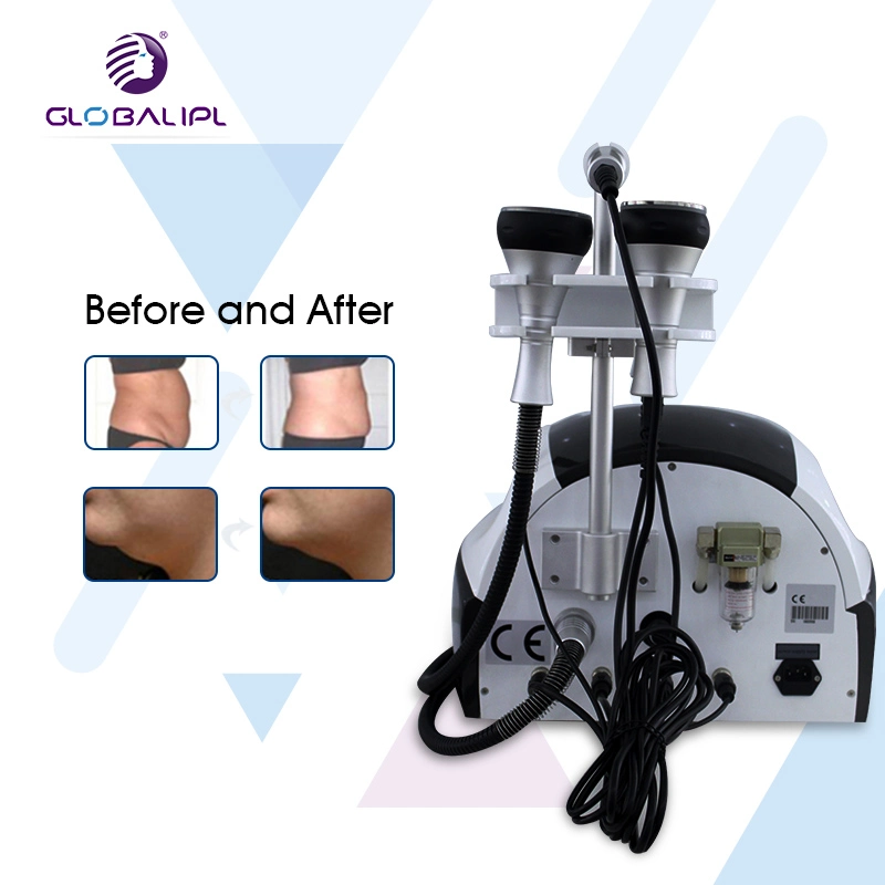 Ultrasonic Cavitation Tripolar RF Slimming Machine