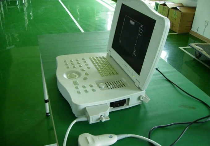 Портативная система 3D-изображений ультразвукового сканера оборудования (после порога - LT002)