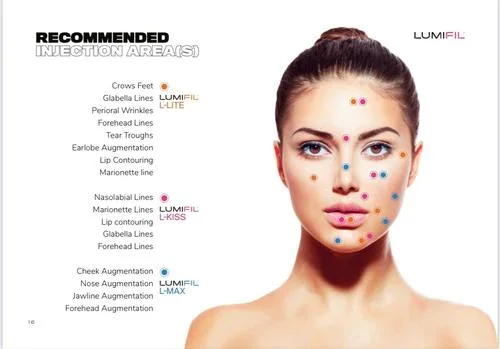 CE Approved Lumifil Ultra High Purity Hyaluronic Acid Kiss Lit Max 1ml Injectable Ha Dermal Filler