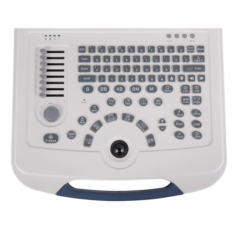 China CE Approved Mecanmed Laptop Doppler 4D Machine Scanner Portable Device Bw Ultrasound