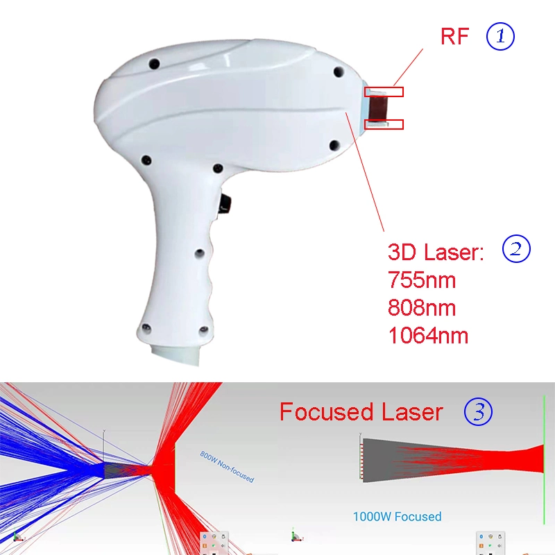 Europe Diode+RF Combined Diode Laser Hair Removal RF Skin Care with Focused Laser