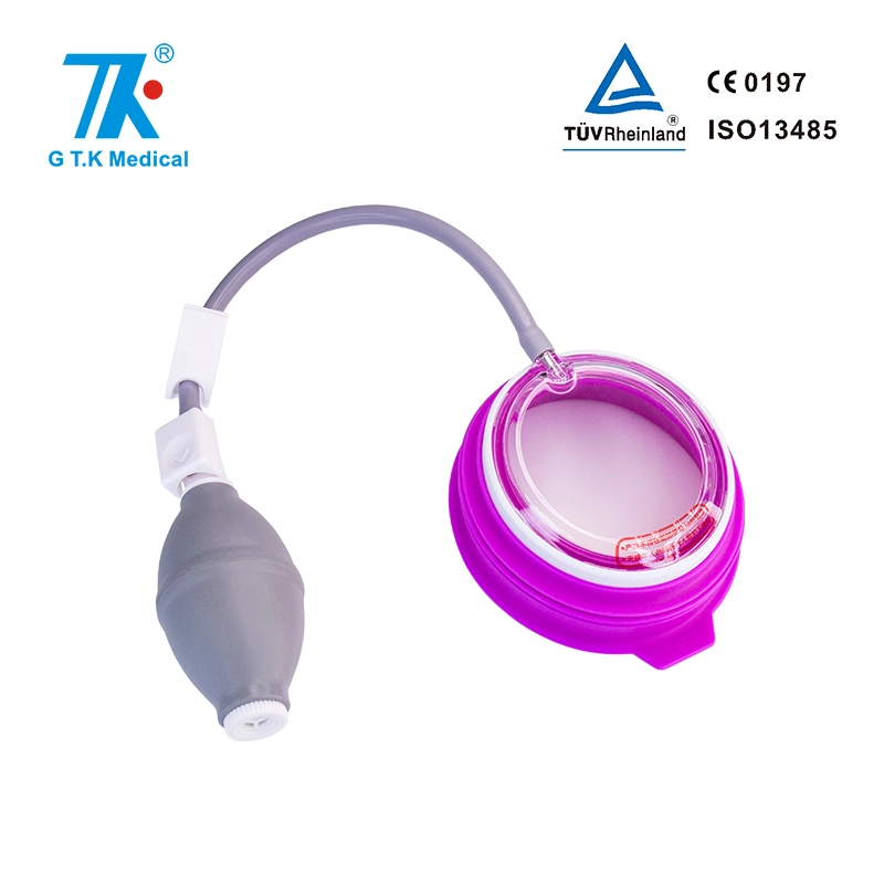 Vacuum Bell for Pectus Excavatum