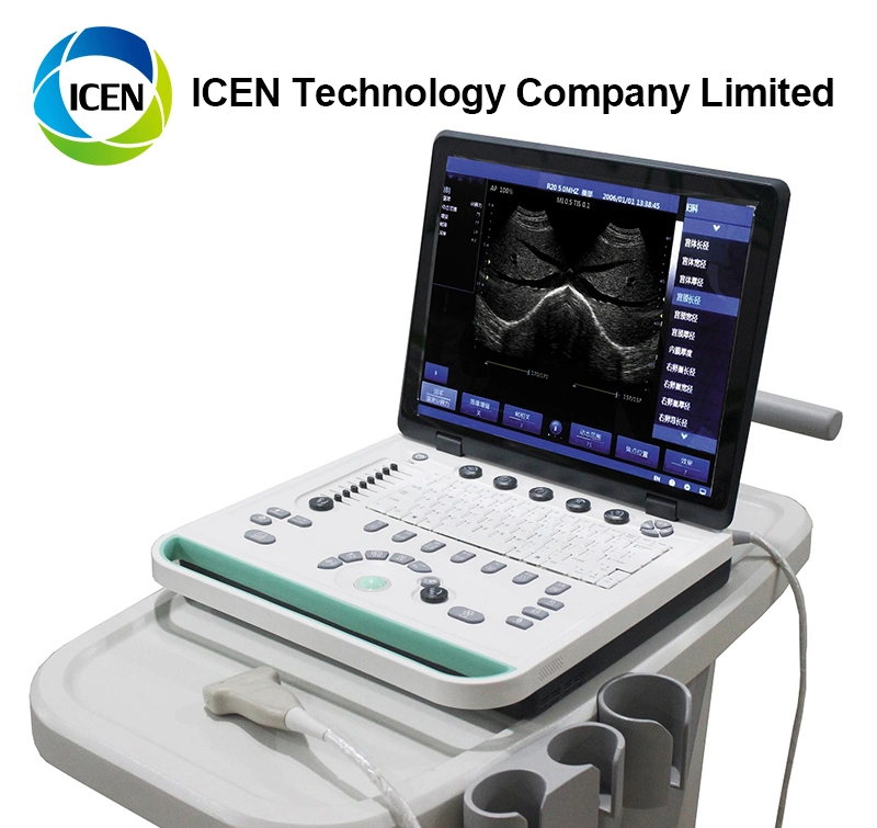 IN-A032-2 ICEN Portable Digital Ultrasound Machine Pregnancy Equipment