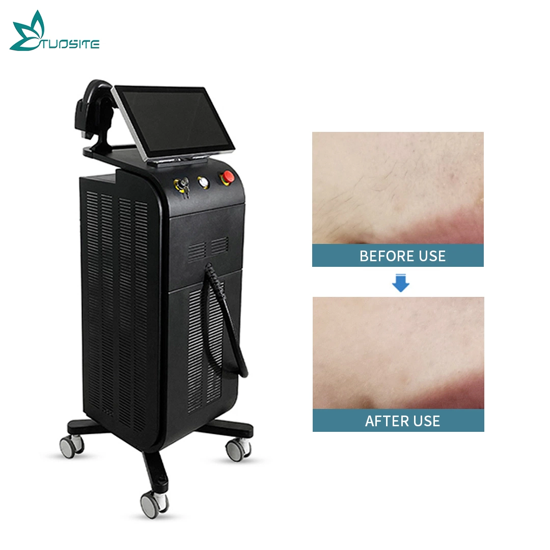 Laser Hair Removal Ice Speed 755nm 808nm 1064nm Permanent Diode Hair Removal Beauty Equipment