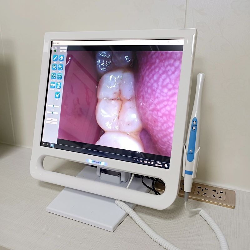 Professionelle Oral Equipment HD Touch Screen 720p Freie Software unterstützt Dental Intraoral Camera All-in-One-Computer