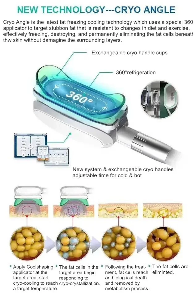 Máquina de criopreservação Crio portátil 360 Kryolipolyse Corpo do dispositivo máquina de emagrecimento a perda de peso