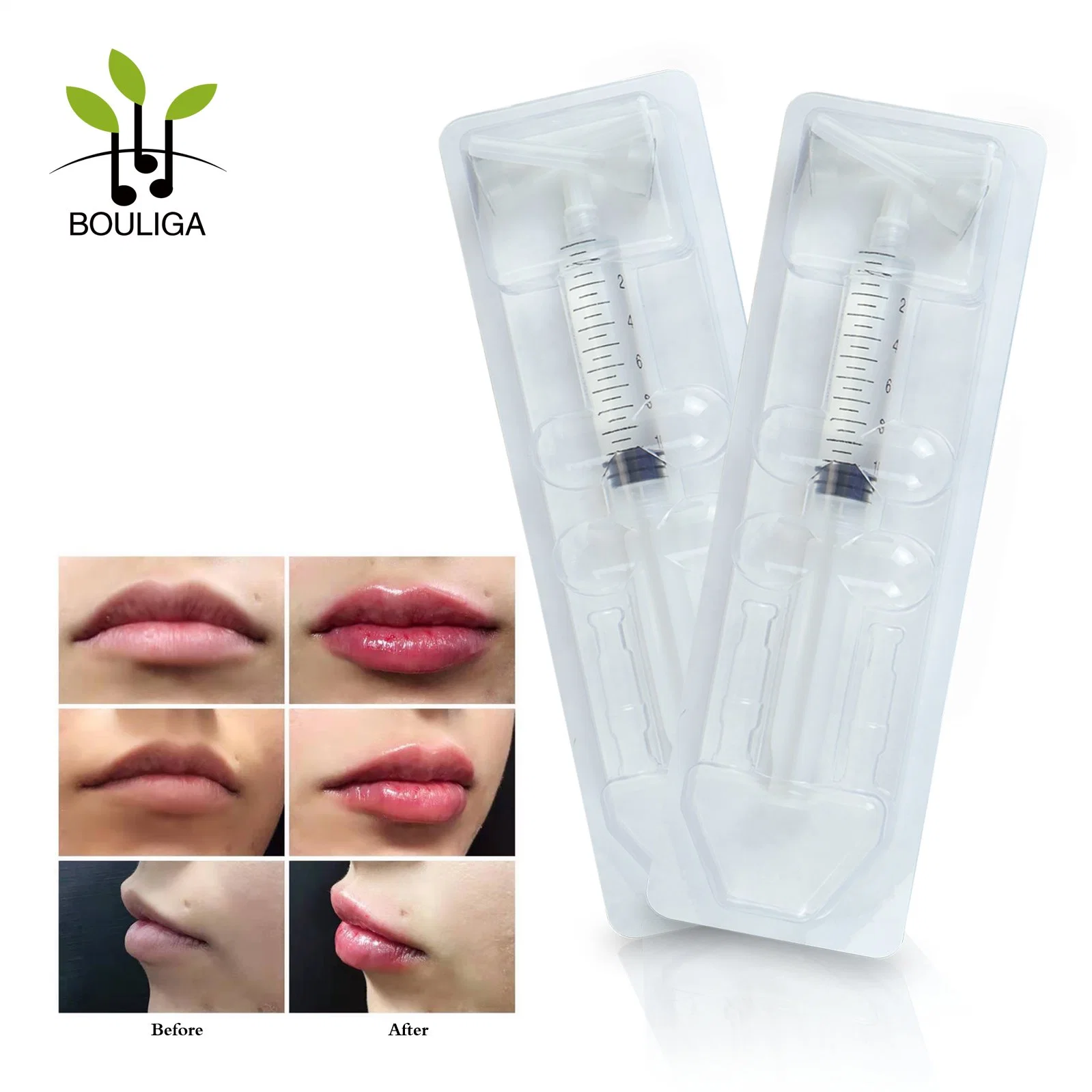 Bouliga Cross Linked Ha 10ml Recommend You Our Top-Rated Dermal Filler for Lips