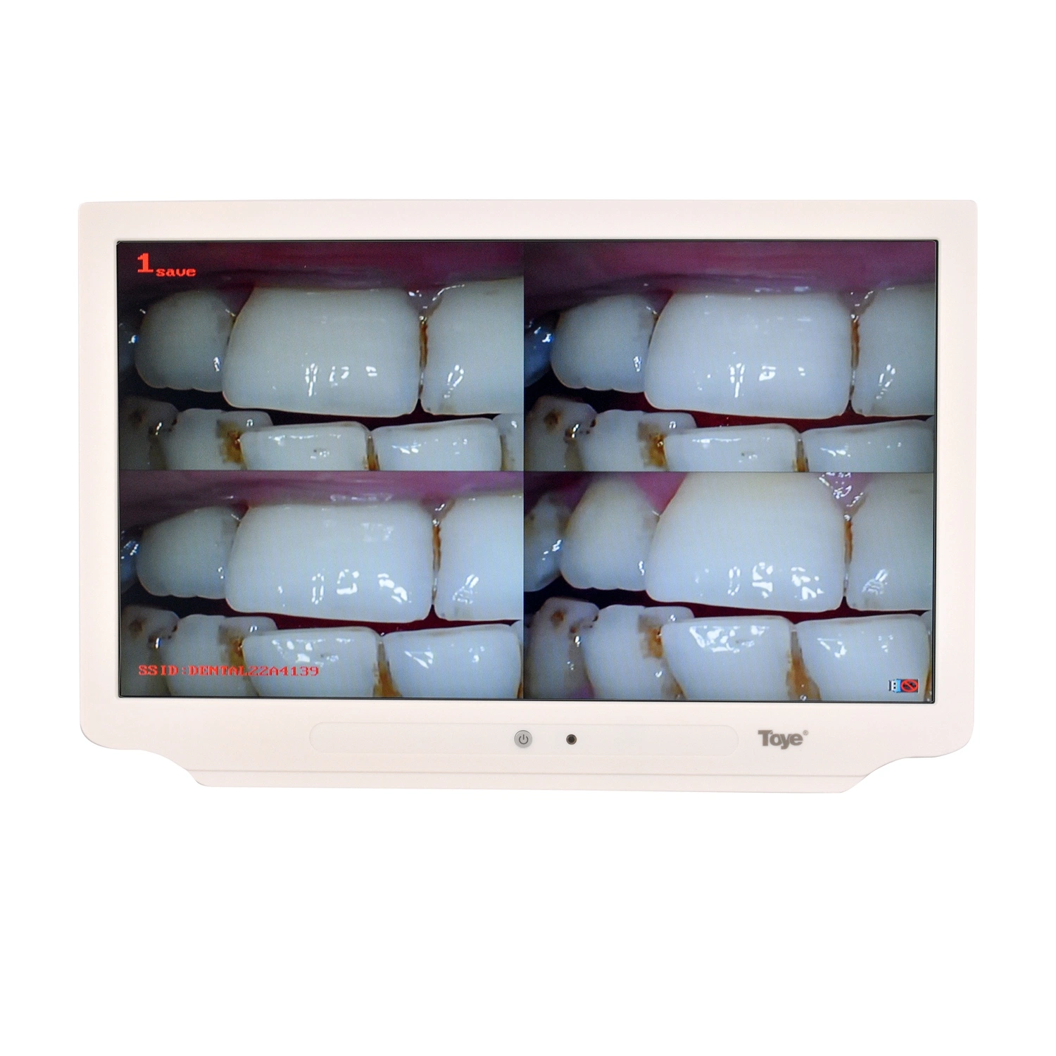 17дюйма ультратонких монитор 10 мегапикселей High Definition стоматологическая программа просмотра цифровых фотокамер перорального камеры устные камера с мультимедиа