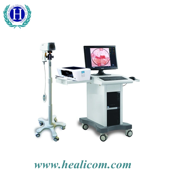 Medical Image System Hkn-2300 Digital Video Vaginal Diagnostic Optical Colposcope