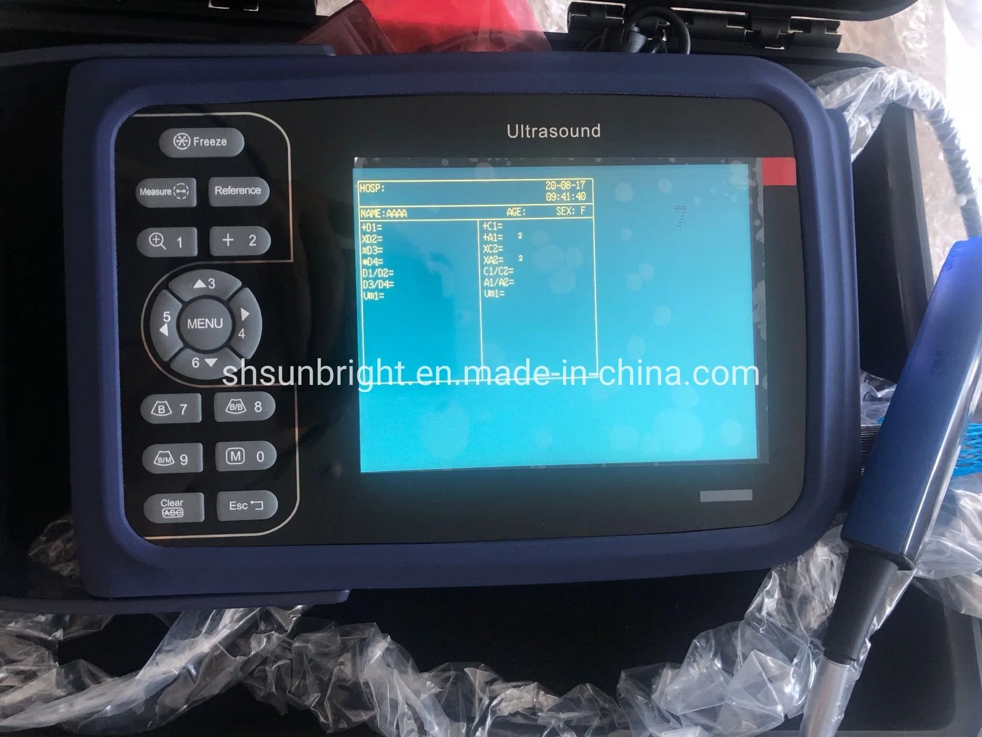 Test Pregnancy Veterinary Handheld Ultrasound Laptop Ultrasound Machine Price