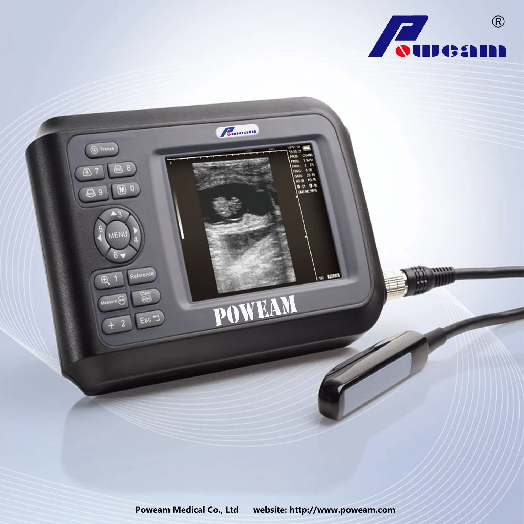 Ce Digital Portable Palmtop Ultrasound Scanner Whyb4000