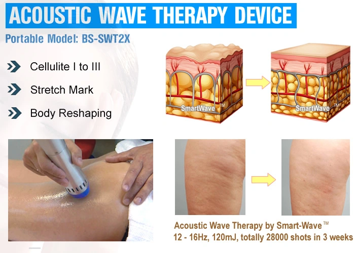 Shockwave Beauty Salon Equipment Shock Wave Therapy Machine Price Shock Wave Cellulite Remove and Weight Loss