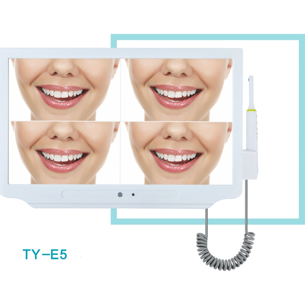 Appareil photo intra-buccal tout-en-un avec système d'endoscope dentaire WiFi de surveillance en option