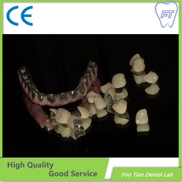 Ponte de Implante Fresada por CAD/CAM Dental de um Laboratório Dentário da China.