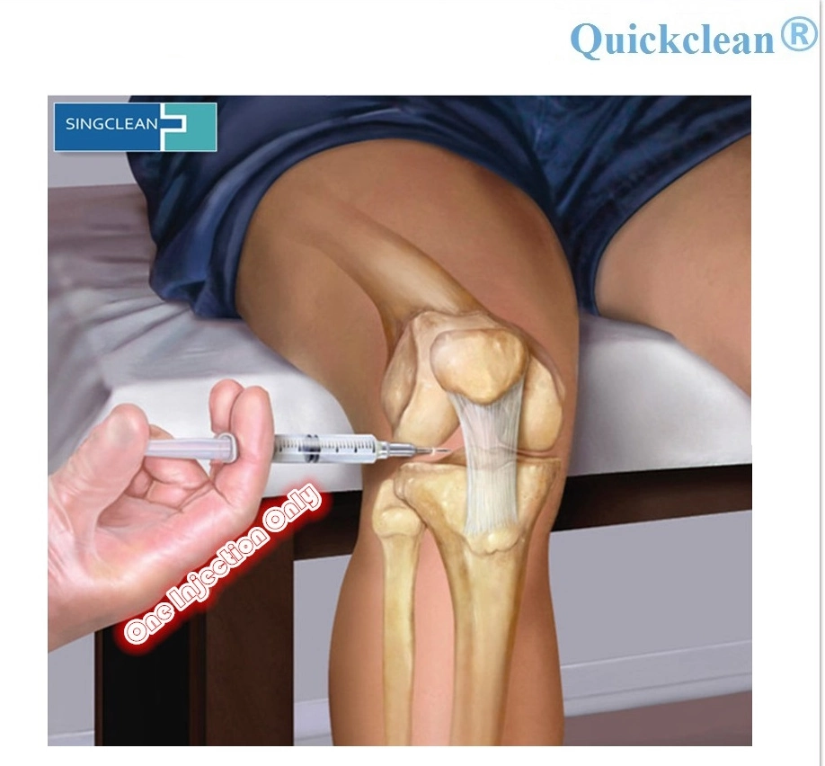 Quickclean One Shot Medical Sodium Hyaluronate Gel Hyaluronic Acid Intra-Articular Knee Injection for Pain Relief Bone Joint with CE