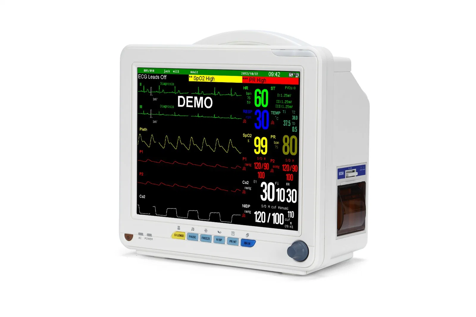 La CE aprobó 12,1 pulgadas de la ICU de ECG de Monitor de Paciente con la capnografía para equipo médico