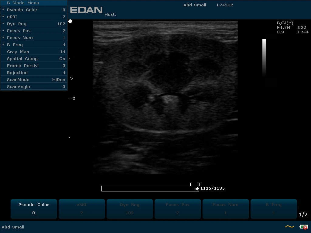 Edan U2 Veterinary Trolley Ultrasound Machine con Convex/Linear/Transvaginal Transducer