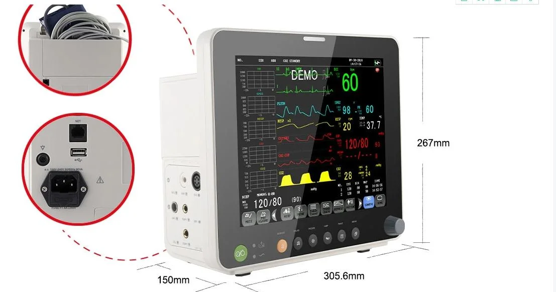 Múltiples parámetros portátil equipamiento médico Monitor de paciente de la ICU de buena calidad a bajo precio