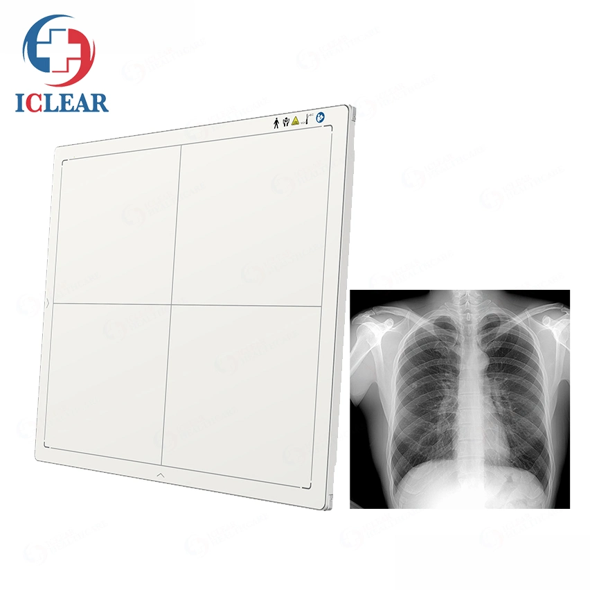 Iray 17X17 Com fio Sem fio Radiografia Digital Detector de Painel Plano