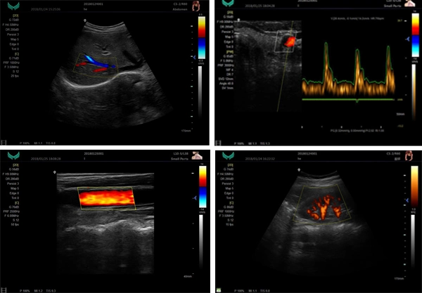 Trolley Color Doppler Ultrasound Scanner System Competitive Price Xf7500