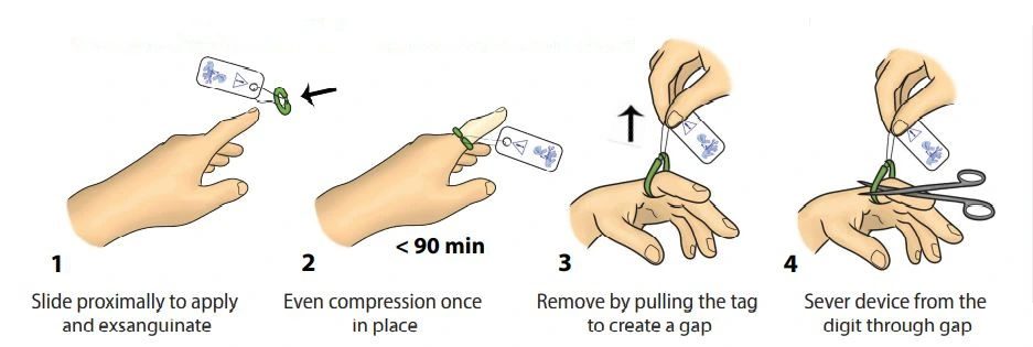 Medical Grade Fingers and Toes Disposable Digit Tourniquet