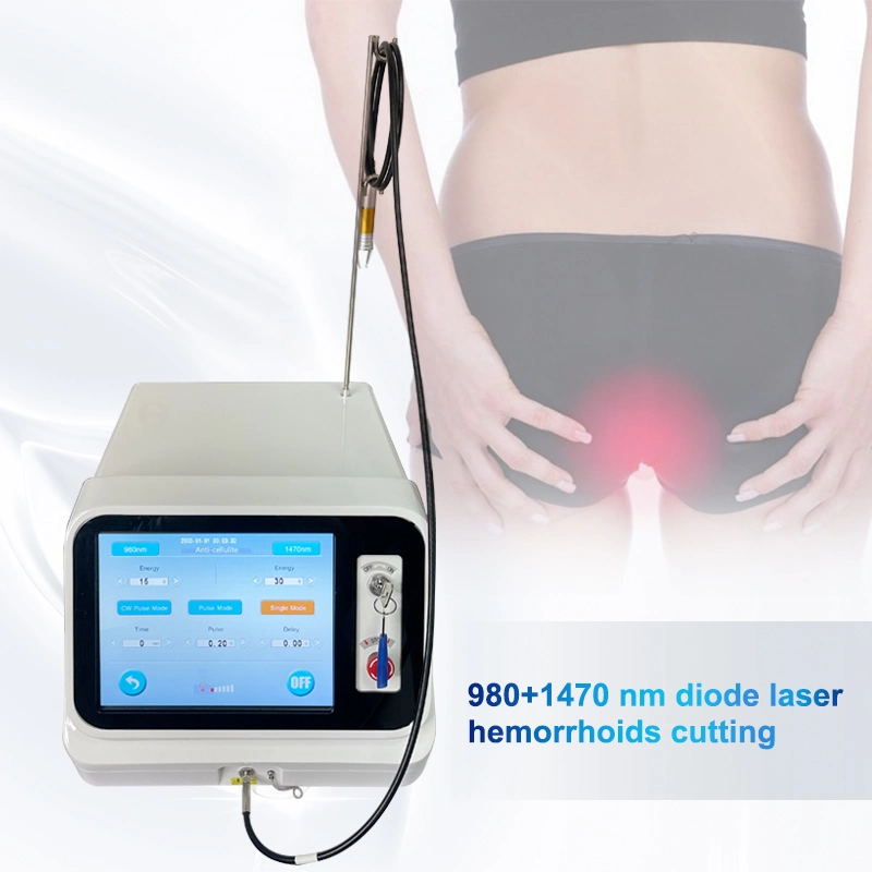 Tratamento indolor para fístulas laser de díodo inteligentes Hemorrhoids 980 Díodo laser 980 Nm 1470 Nm equipamento