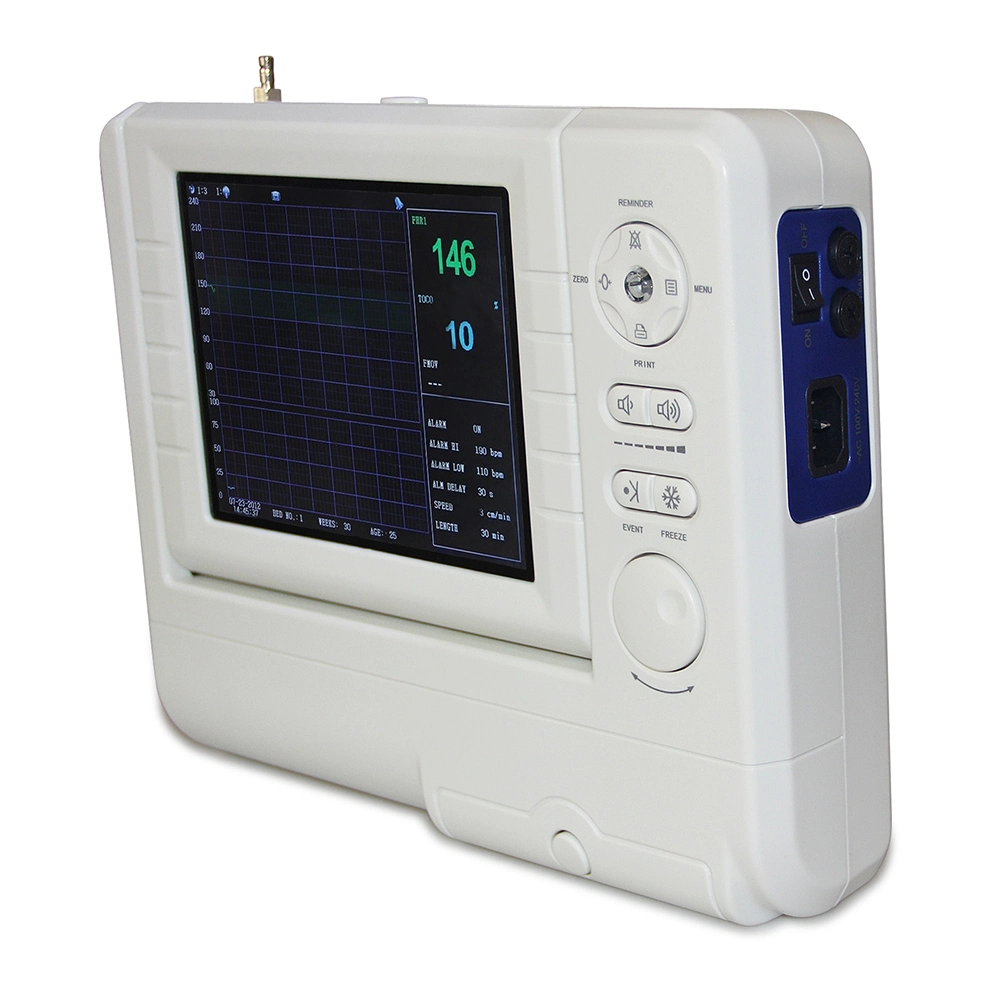 Portable Color Ultrasound Machine Ctg Fetal Monitor