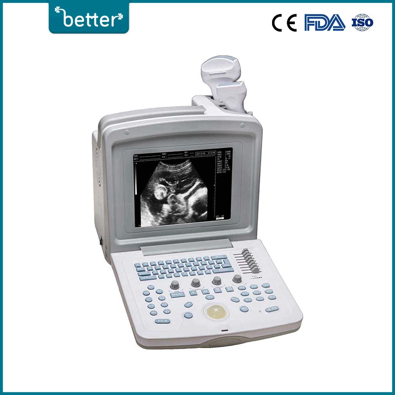 Medical Equipment Full Digital Portable B/W Ultrasound Scanner for Veterinary Use