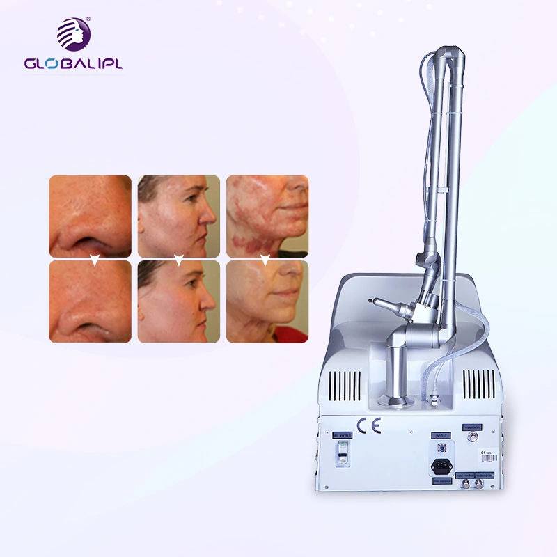 Home Use Vagina Tightening Portable Fractional CO2 Laser Beauty Equipment Smooth Scars