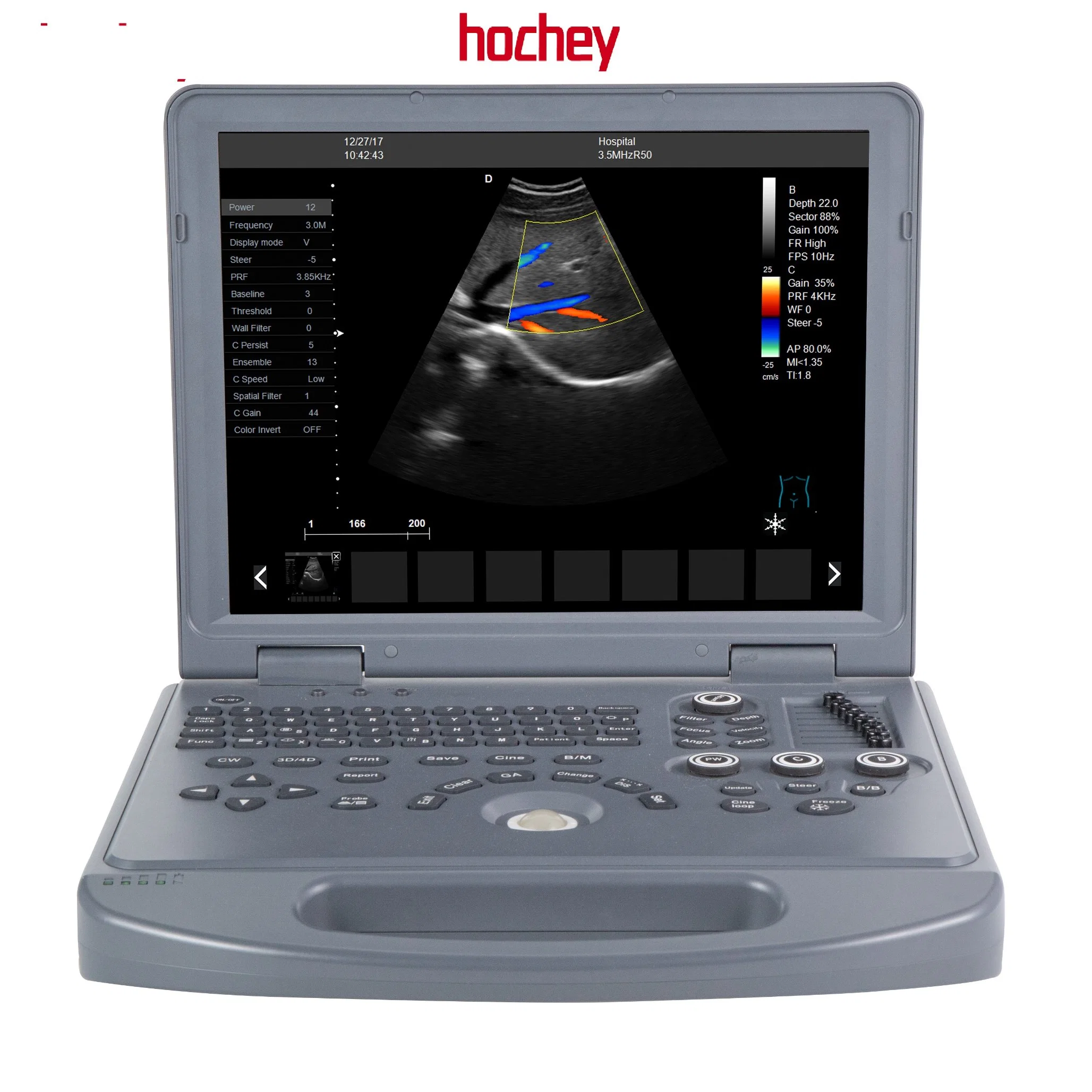 Hochey Medical Chinese Factory Preis Farbdoppler 3D Ultraschall-Maschine