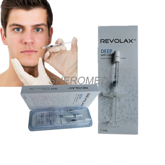 1ml Revolax Sodium Hyaluronate for Nose Augmentation